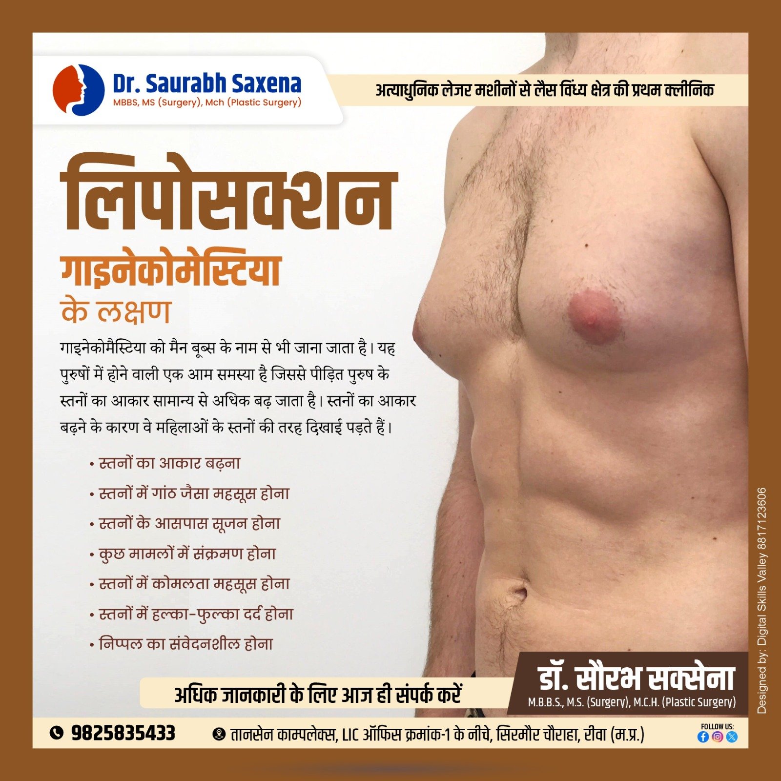 Gynecomastia Treatment