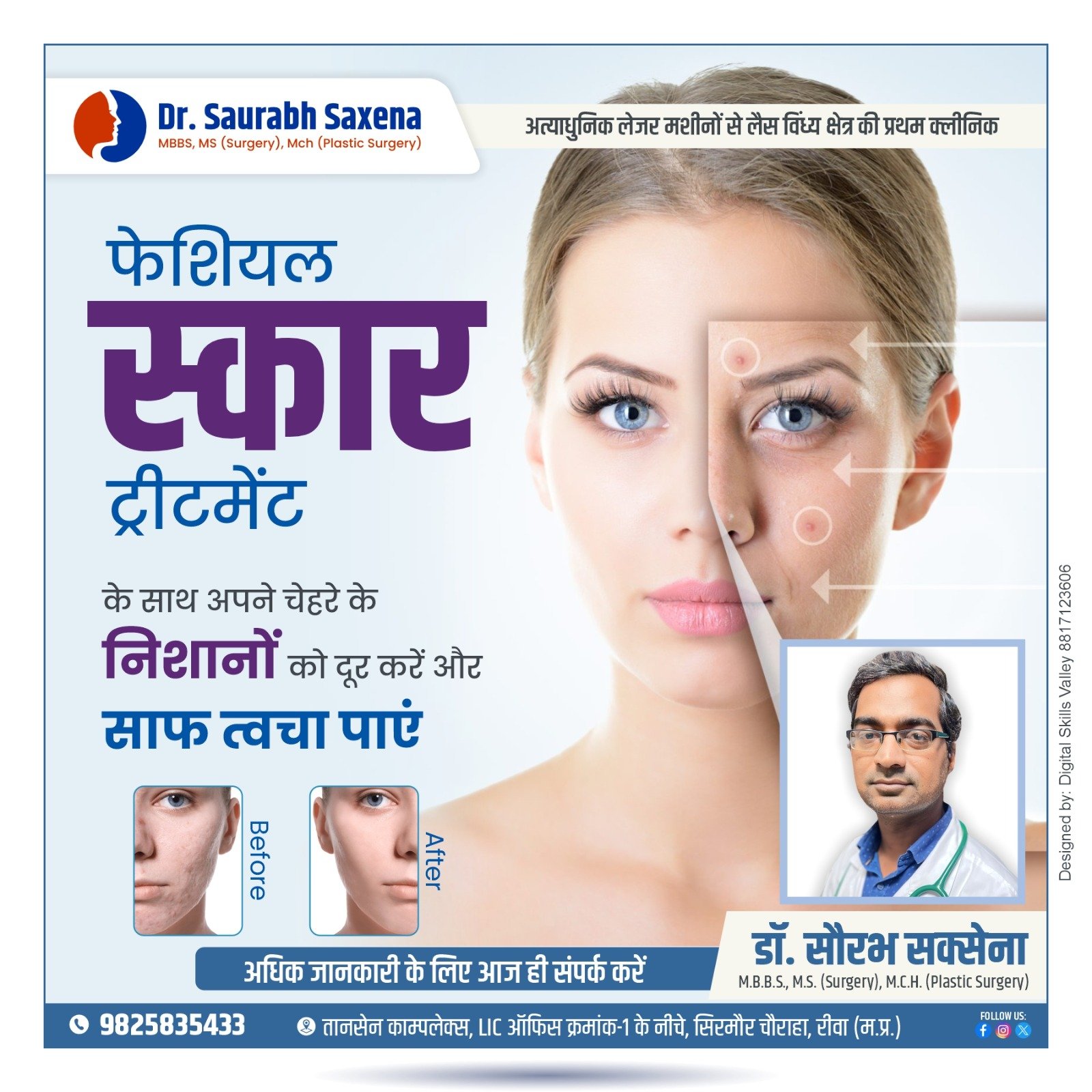 Facial Scar Treatment